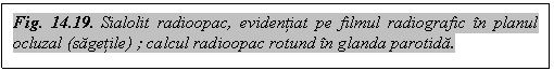 Text Box: Fig. 14.19. Sialolit radioopac, evidentiat pe filmul radiografic in planul ocluzal (sagetile) ; calcul radioopac rotund in glanda parotida.